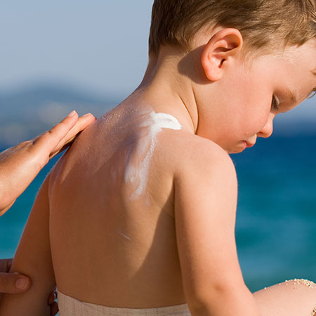 2022 June Blog How To Prevent Sunburns This Summer 450x450 